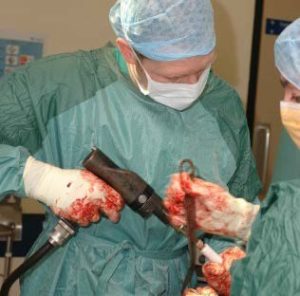 Mch Orthopedic Surgery University of Dundee