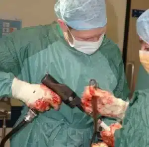 ms orthopaedic surgery courses in uk